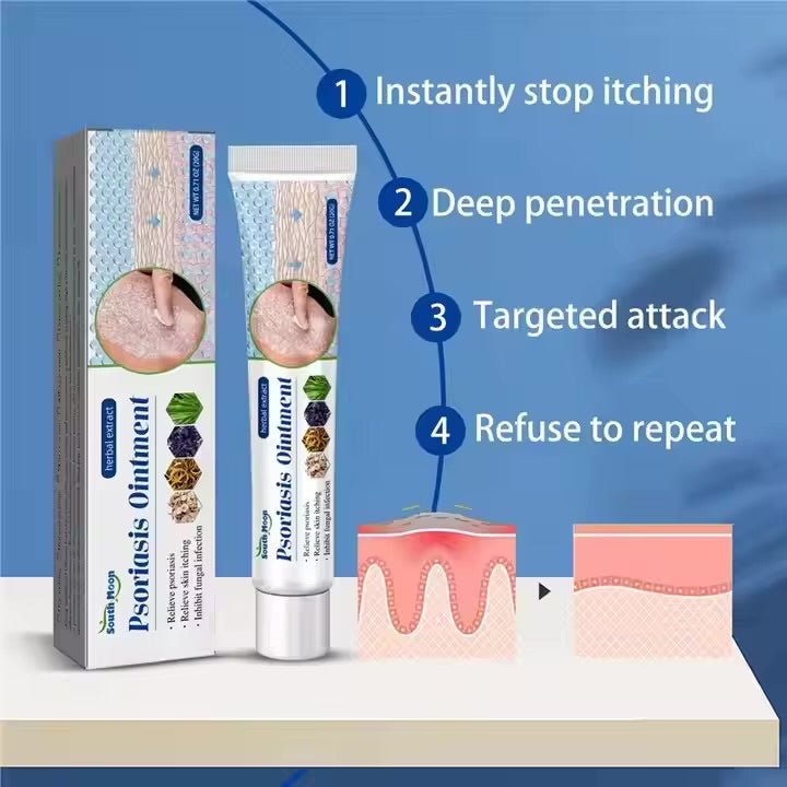 South Moon Psoriasis Relief Cream 20g