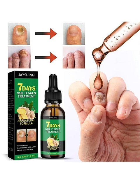 JaySuing 7Days Nail Fungus Treatment 30ML