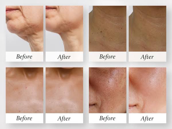 Eelhoe Retinol Neck Cream 40g