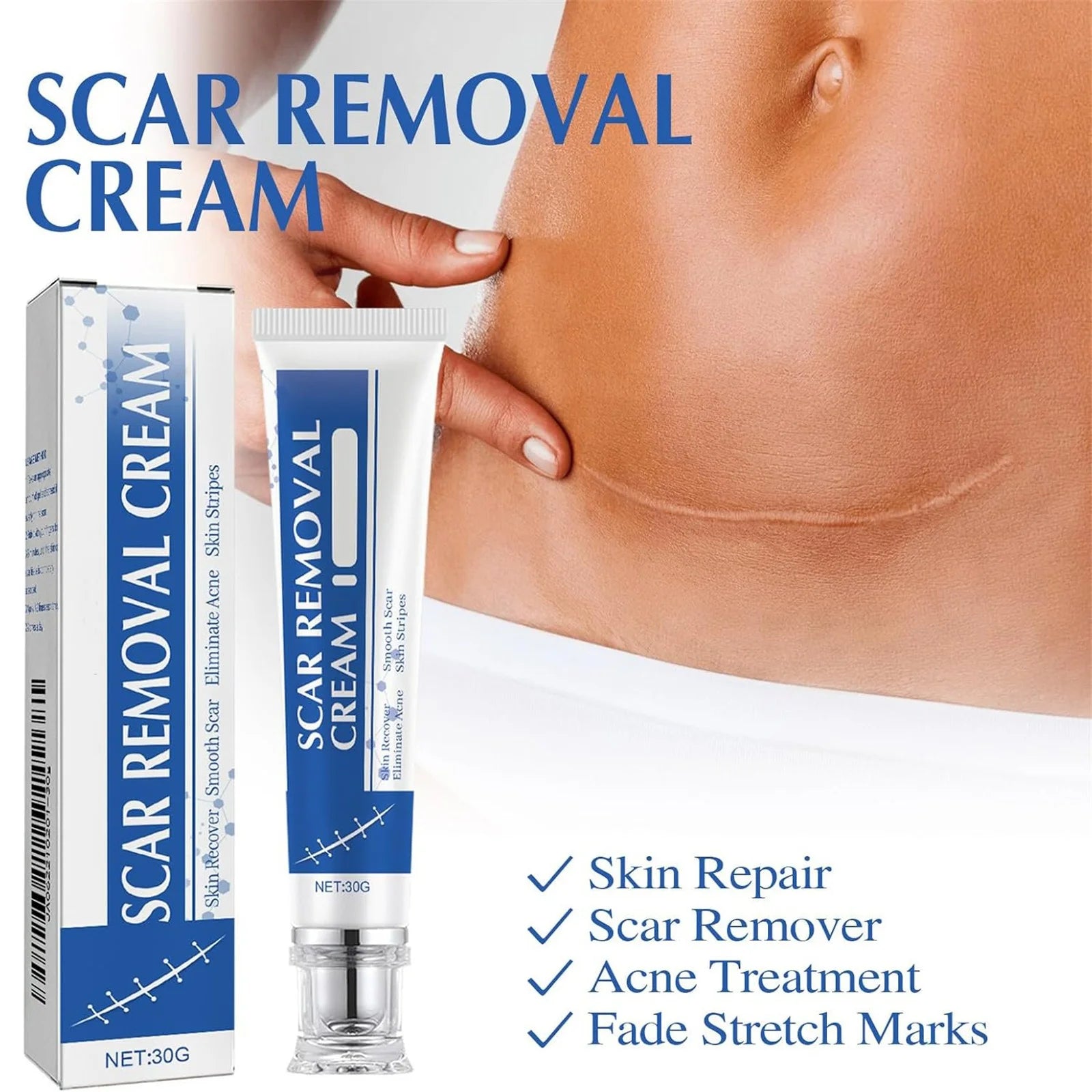Scar Removal Cream JaySuing