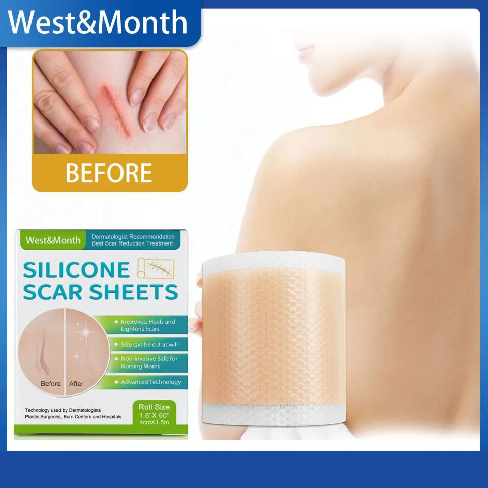 Silicone Scar Repair Sheets