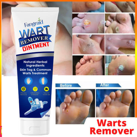 Eelhoe Wart Remover Ointment