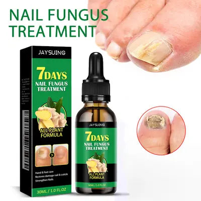 JaySuing 7Days Nail Fungus Treatment 30ML