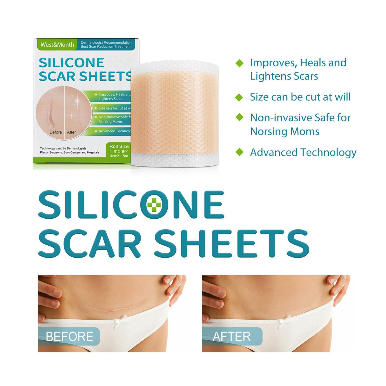 Silicone Scar Repair Sheets