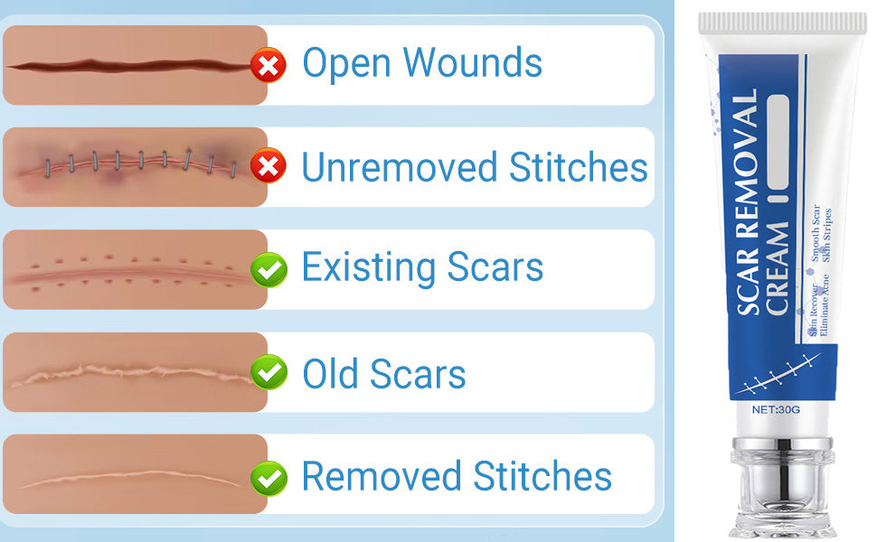 Scar Removal Cream JaySuing