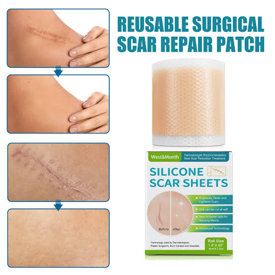 Silicone Scar Repair Sheets