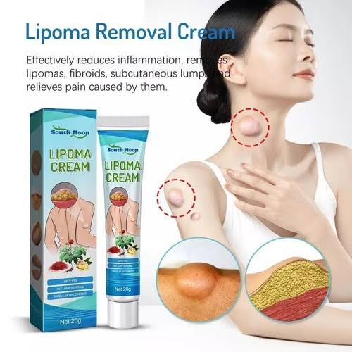 South Moon Lipoma Cream