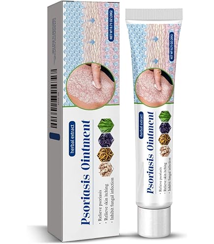 South Moon Psoriasis Relief Cream 20g