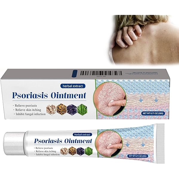 South Moon Psoriasis Relief Cream 20g