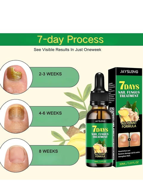 JaySuing 7Days Nail Fungus Treatment 30ML