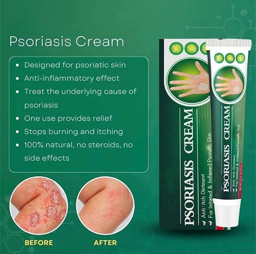 Psoriasis Relief Cream