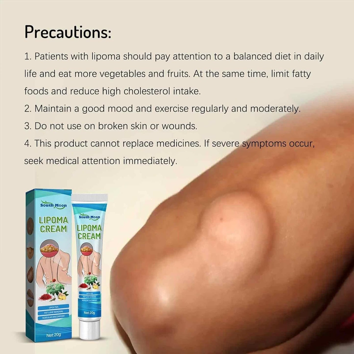 South Moon Lipoma Cream