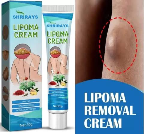 South Moon Lipoma Cream