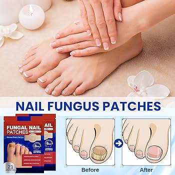 Nail Treatment - Intensive Repair for Damaged & Discolored Nails