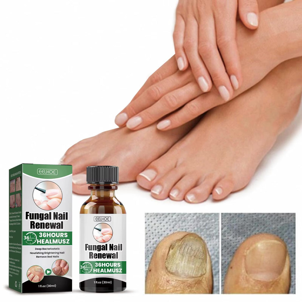 Eelhoe Fungal Nail Serum 30ml