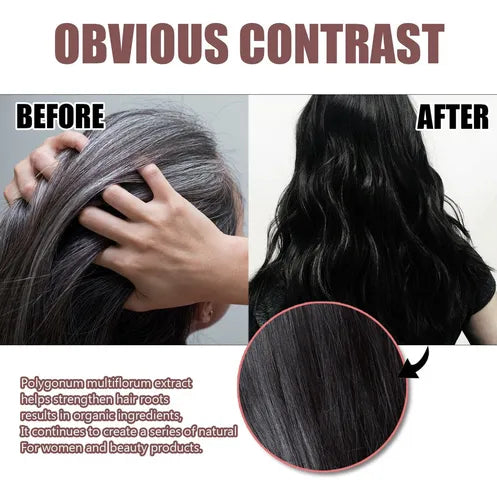 Eelhoe Nourishing Repairing Anti-hair Loss Shampoo Dye Polygonum Bar Soap 100g