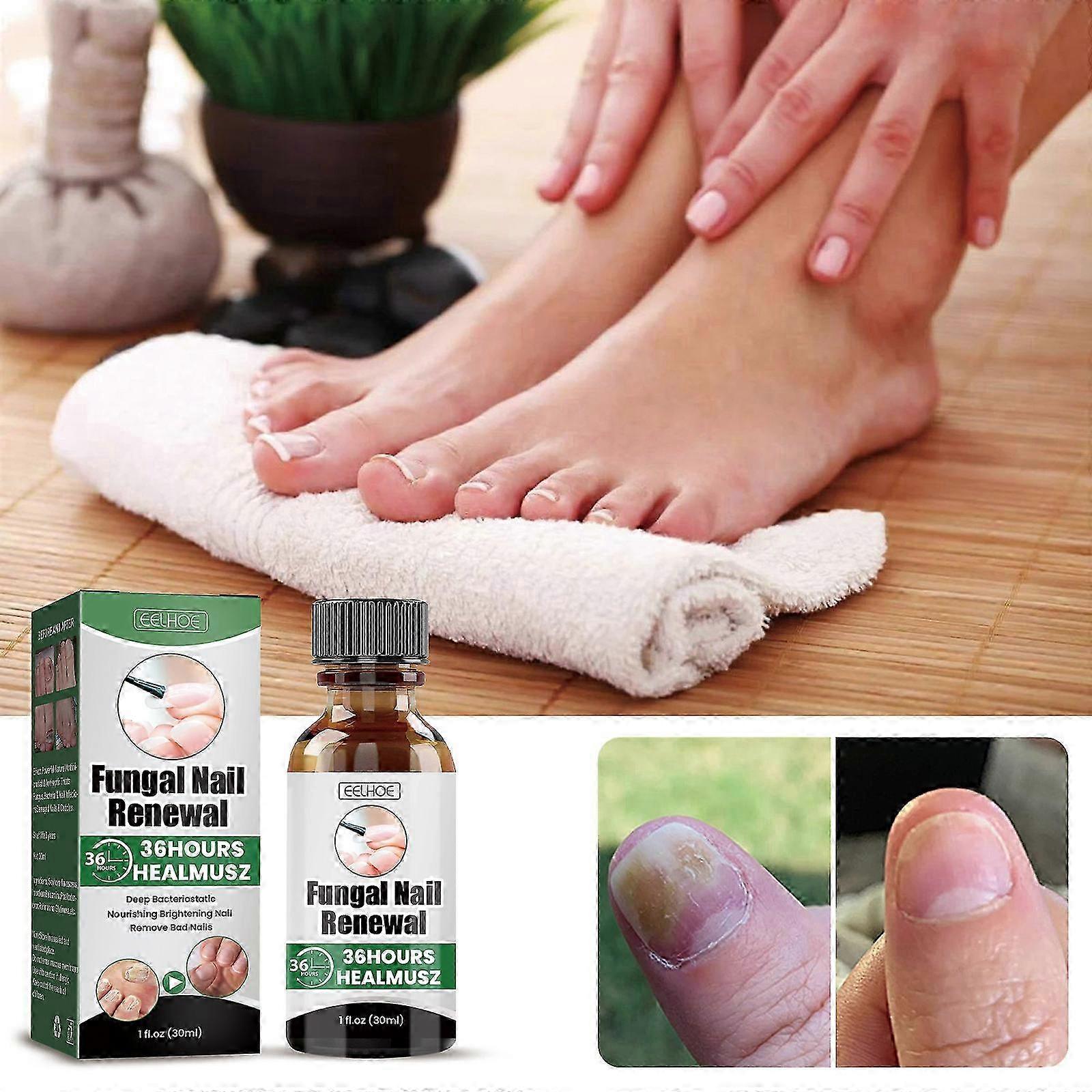 Eelhoe Fungal Nail Serum 30ml