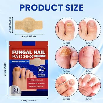 Nail Treatment - Intensive Repair for Damaged & Discolored Nails