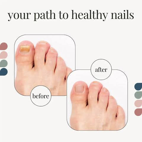 Nail Treatment - Intensive Repair for Damaged & Discolored Nails