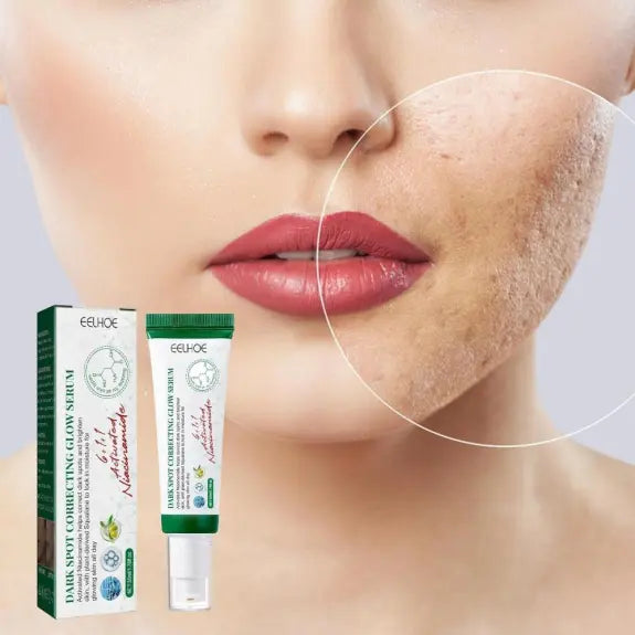 Eelhoe Dark Spot Glowing Serum